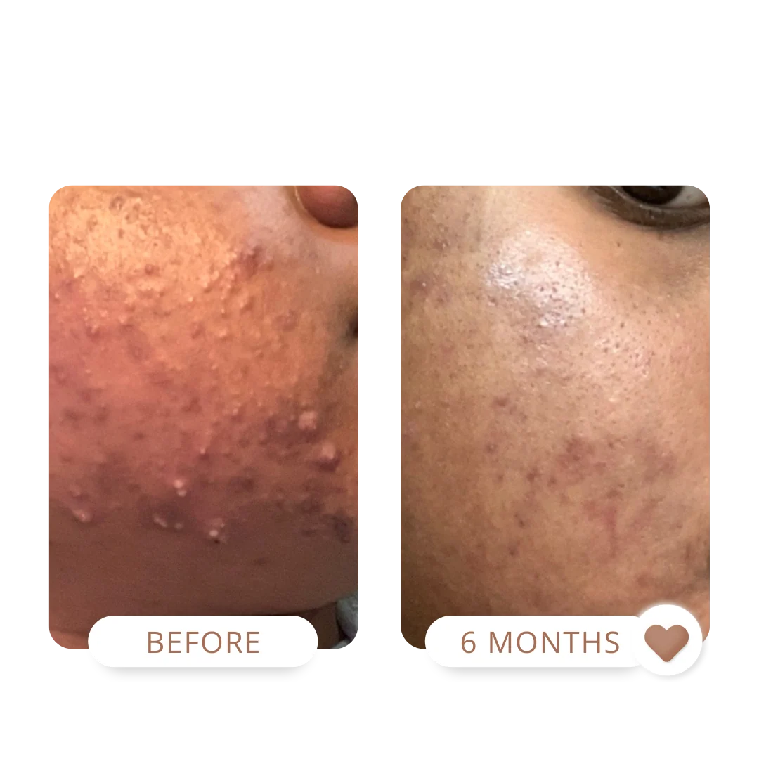 The Trifecta™ 3-Piece Combination Skin Kit