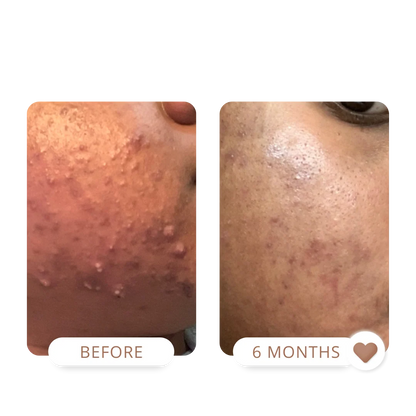 The Trifecta™ 3-Piece Combination Skin Kit