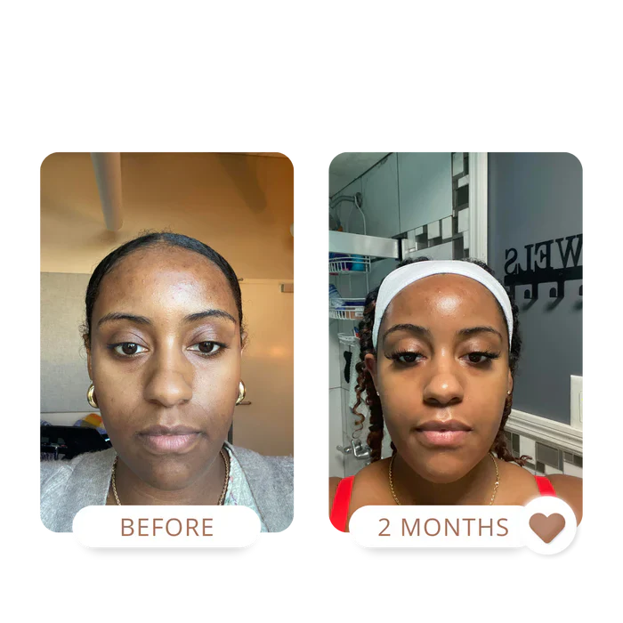 MATTE MADE IN HEAVEN | OILY SKIN KIT