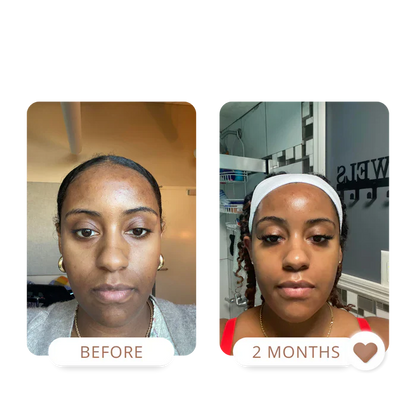MATTE MADE IN HEAVEN | OILY SKIN KIT